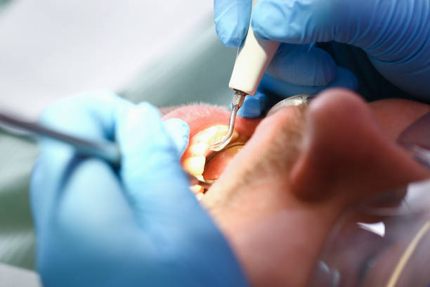 Best Cosmetic Emergency Dentistry in Colquitt, GA