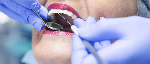 Best Emergency Treatment for Dental Infections or Abscesses in Colquitt, GA